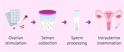 impregnationsex|Insemination .